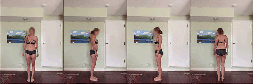 Rolfing Before and After
