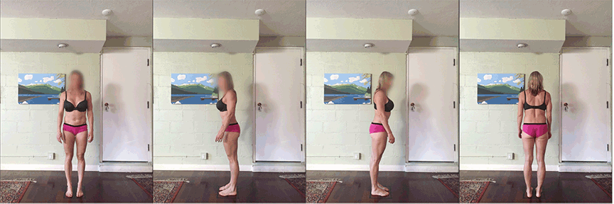 Rolfing Before and After